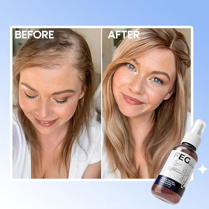 FEG Plus™ Hair & Scalp Care Spray  Scalp Nourishment • Supports Stronger-Looking Hair • Lightweight Spray • Anagain + Procapil + Seaweed Extract  Give Your Hair Roots Extra Ca