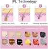 Mini IPL Hair Removal Device™  Salon-Inspired Hair Reduction • 5 Energy Levels • Auto & Manual Modes • Easy At-Home Use