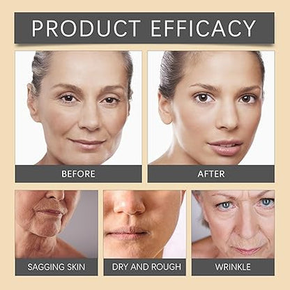 OUHOE Bee Venom Wrinkle Cream™  Smooth-Looking Skin • Deep Hydration • Firmer-Looking Texture • Youthful Glow